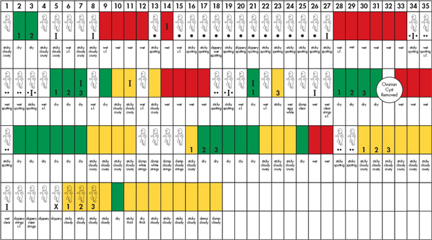 chart ovariancyst 625